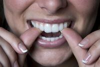teeth Tooth Whitening Gel Kit Whitelight White Light ★