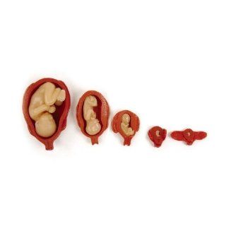 Uterus/Fetus Model Set (5) Toys & Games