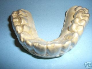 Custom Teeth Tooth Acrylic Dental Night Guard Bruxism