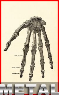 Bones of Human Hand Anatomy Vintage Medical Chart METAL Wall Sign